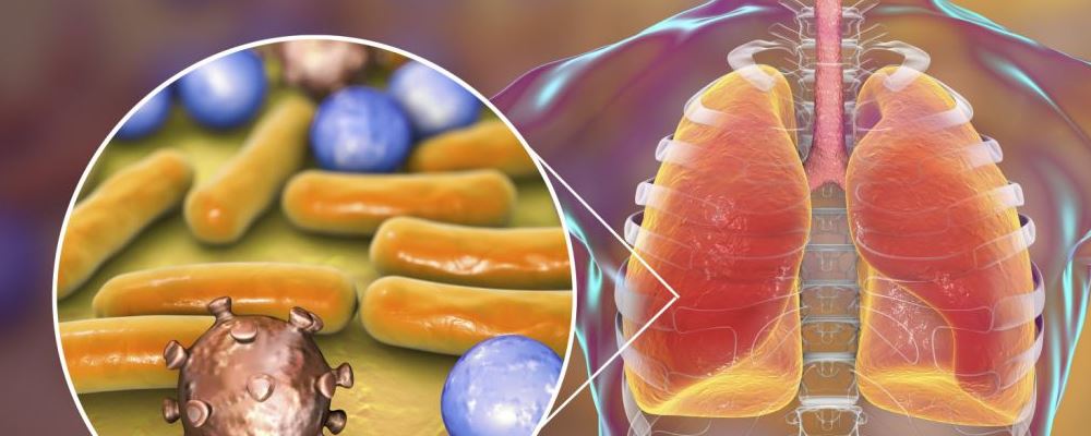 新型冠状病毒的传播途径 病毒在空气中可以存活多久 人体对新冠病毒能否自愈