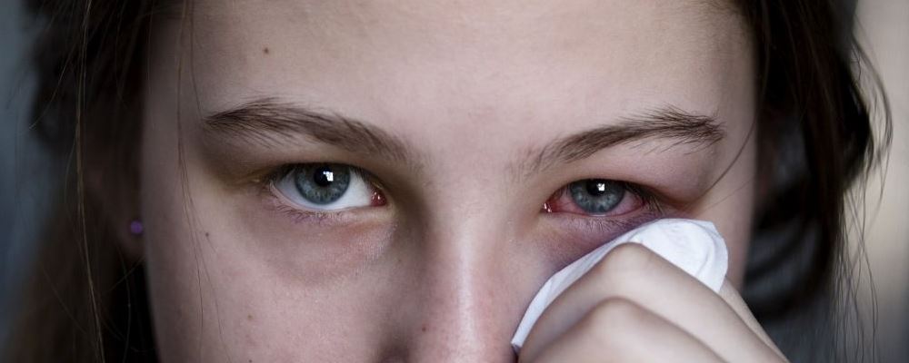 哪些 危害 及时 红眼病 症状 分泌 感染 引起 治疗 出血 淋巴 